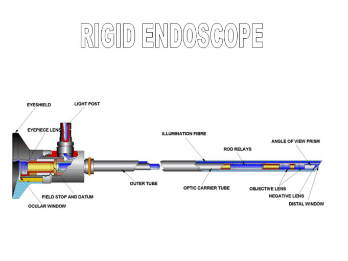 https://www.fyendoscopy.com/uploads/image/20211027/14/rigid-endoscope-vs-flexible-endoscope.jpg